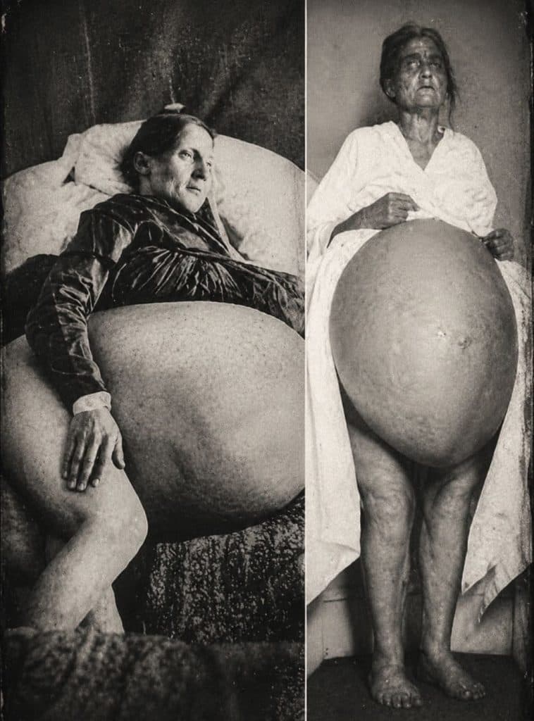 The Truth Hidden Inside Her Abdomen Shocked the Medical World.