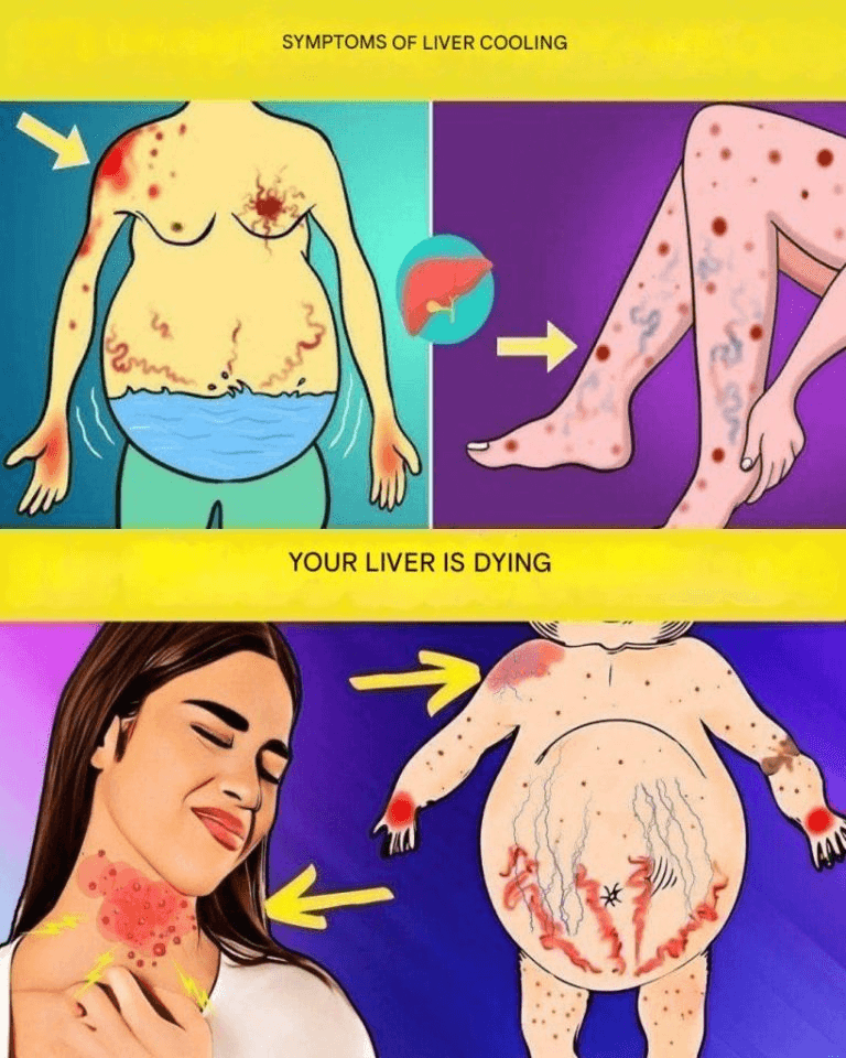17 Warning Signs Your Liver May Be Trying to Tell You Something