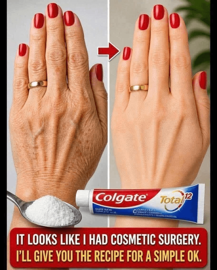 Why Your Hands May Look Older Than You Feel: Common Causes of Age Spots and Skin Changes